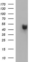 HEK293T cells were transfected with the pCMV6-ENTRY control (Left lane) or pCMV6-ENTRY PARVB (Right lane) cDNA for 48 hrs and lysed. Equivalent amounts of cell lysates (5 ug per lane) were separated by SDS-PAGE and immunoblotted with anti-PARVB.