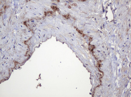 IHC of paraffin-embedded Human pancreas tissue using anti-PARVB mouse monoclonal antibody.