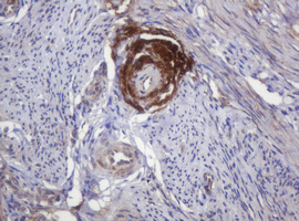 IHC of paraffin-embedded Human endometrium tissue using anti-PARVB mouse monoclonal antibody.