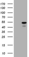 HEK293T cells were transfected with the pCMV6-ENTRY control (Left lane) or pCMV6-ENTRY PARVB (Right lane) cDNA for 48 hrs and lysed. Equivalent amounts of cell lysates (5 ug per lane) were separated by SDS-PAGE and immunoblotted with anti-PARVB.