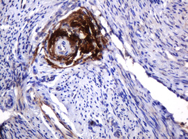 IHC of paraffin-embedded Human endometrium tissue using anti-PARVB mouse monoclonal antibody. (Heat-induced epitope retrieval by 10mM citric buffer, pH6.0, 120°C for 3min).