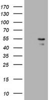 HEK293T cells were transfected with the pCMV6-ENTRY control (Left lane) or pCMV6-ENTRY PARVB (Right lane) cDNA for 48 hrs and lysed. Equivalent amounts of cell lysates (5 ug per lane) were separated by SDS-PAGE and immunoblotted with anti-PARVB.