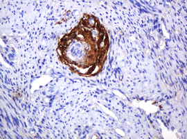 IHC of paraffin-embedded Human endometrium tissue using anti-PARVB mouse monoclonal antibody. (Heat-induced epitope retrieval by 10mM citric buffer, pH6.0, 120°C for 3min).