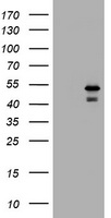 HEK293T cells were transfected with the pCMV6-ENTRY control (Left lane) or pCMV6-ENTRY PARVB (Right lane) cDNA for 48 hrs and lysed. Equivalent amounts of cell lysates (5 ug per lane) were separated by SDS-PAGE and immunoblotted with anti-PARVB.