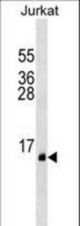 PATE1 Antibody western blot of Jurkat cell line lysates (35 ug/lane). The PATE1 antibody detected the PATE1 protein (arrow).