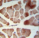 PATL1 Antibody IHC of formalin-fixed and paraffin-embedded skeletal muscle followed by peroxidase-conjugated secondary antibody and DAB staining.