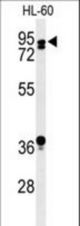 Western blot of PATL1 Antibody in HL-60 cell line lysates (35 ug/lane). PATL1 (arrow) was detected using the purified antibody.