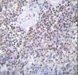 PATL2 Antibody immunohistochemistry of formalin-fixed and paraffin-embedded human spleen tissue followed by peroxidase-conjugated secondary antibody and DAB staining.