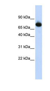 PATZ1 antibody LS-C101727 Western blot of HepG2 cell lysate.