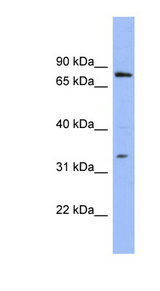 PATZ1 antibody LS-C107490 Western blot of OVCAR-3 cell lysate.