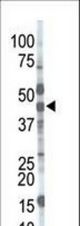 The anti-MGAT1 antibody is used in Western blot to detect MGAT1 in mouse brain tissue lysate.