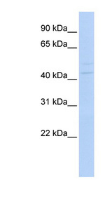 PAX1 antibody LS-C109888 Western blot of MCF7 cell lysate.