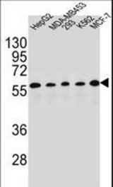 PAX1 Antibody western blot of HepG2,MDA-MB453,293,K562,MCF-7 cell line lysates (35 ug/lane). The PAX1 antibody detected the PAX1 protein (arrow).