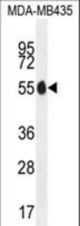 PAX1 Antibody western blot of MDA-MB435 cell line lysates (35 ug/lane). The PAX1 antibody detected the PAX1 protein (arrow).