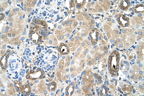 MGAT2 antibody LS-C40495 IHC of formalin-fixed, paraffin-embedded human Kidney. Positive label: Epithelial cells of renal tubule indicated with arrows. Antibody concentration 4-8 ug/ml. Magnification 400X.