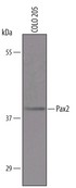 Detection of Human Pax2 by Western Blot. Western blot shows lysates of COLO 205 human colorectal adenocarcinoma cell line. PVDF Membrane was probed with 1 ug/ml of Goat Anti-Human Pax2 Antigen Affinity-purified Polyclonal Antibody followed by HRP-conjugated Anti-Goat IgG Secondary Antibody. A specific band was detected for Pax2 at approximately 40 kD (as indicated). This experiment was conducted under reducing conditions.