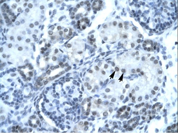 PAX2 antibody LS-C31501 was used in IHC to stain formalin-fixed, paraffin-embedded human kidney.