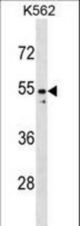 PAX2 Antibody western blot of K562 cell line lysates (35 ug/lane). The PAX2 antibody detected the PAX2 protein (arrow).