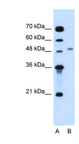 MGAT2 antibody LS-C40495 Western blot of Jurkat lysate.