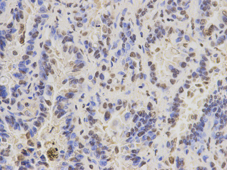 Immunohistochemistry of paraffin-embedded rat lung using PAX3 antibody at dilution of 1:200 (400x lens).