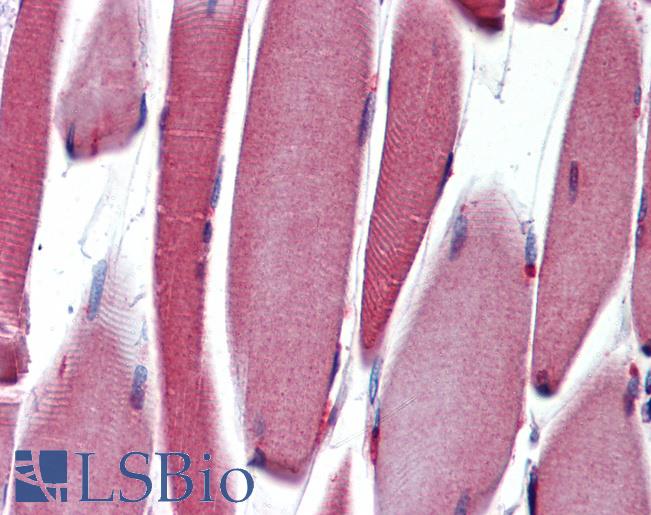 Anti-PAX3 antibody IHC of human skeletal muscle. Immunohistochemistry of formalin-fixed, paraffin-embedded tissue after heat-induced antigen retrieval. Antibody LS-B3737 concentration 10 ug/ml.
