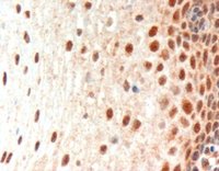 PAX3 antibody (3 ug/ml) staining of paraffin embedded Human Esophagus. Microwaved antigen retrieval with Tris/EDTA buffer pH9, HRP-staining.