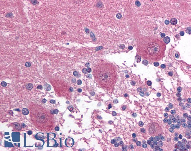 Anti-PAX3 antibody IHC of human brain, cerebellum. Immunohistochemistry of formalin-fixed, paraffin-embedded tissue after heat-induced antigen retrieval. Antibody LS-B1554 concentration 5 ug/ml.