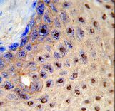 Formalin-fixed and paraffin-embedded human skin reacted with PAX3 Antibody , which was peroxidase-conjugated to the secondary antibody, followed by DAB staining. This data demonstrates the use of this antibody for immunohistochemistry; clinical relevance has not been evaluated.