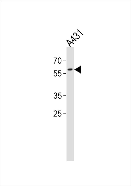PAX3 Antibody western blot of A431 cell line lysates (35 ug/lane). The PAX3 antibody detected the PAX3 protein (arrow).