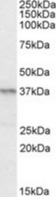 PAX4 antibody (0.2 ug/ml) staining of Mouse Pancreas lysate (35 ug protein/ml in RIPA buffer). Primary incubation was 1 hour. Detected by chemiluminescence.