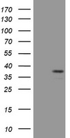 HEK293T cells were transfected with the pCMV6-ENTRY control (Left lane) or pCMV6-ENTRY PAX4 (Right lane) cDNA for 48 hrs and lysed. Equivalent amounts of cell lysates (5 ug per lane) were separated by SDS-PAGE and immunoblotted with anti-PAX4.