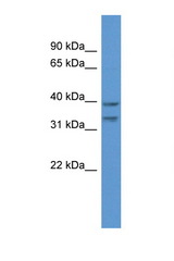 BRMS1L antibody LS-C135501 Western blot of ACHN Cell lysate. Antibody concentration 1 ug/ml.