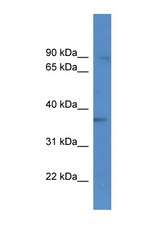BRMS1L antibody LS-C135502 Western blot of HeLa Cell lysate. Antibody concentration 1 ug/ml.