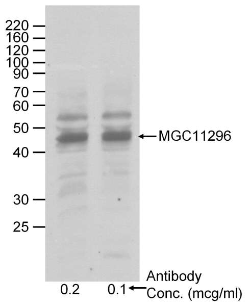 Detection of Human MGC11296 by Western Blot. Sample: RIPA lysate (50 ug) from HeLa cells. Antibody: Affinity purified goat anti-MGC11296 used at the indicated concentrations. Detection: Chemiluminescence with 2 min exposure.