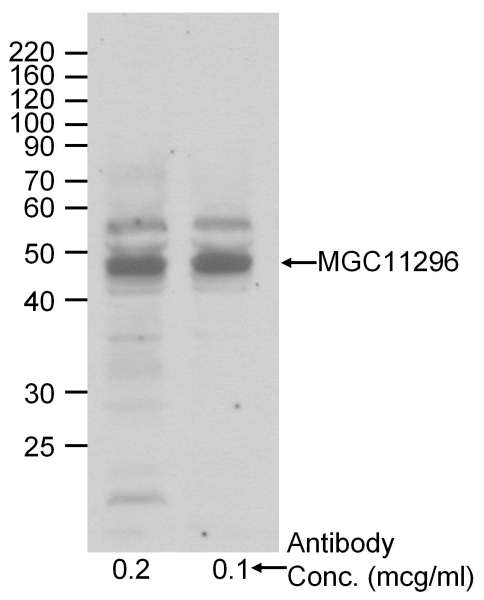 Detection of Human MGC11296 by Western Blot. Sample: RIPA lysate (50 ug) from HeLa cells. Antibody: Affinity purified goat anti-MGC11296 used at the indicated concentrations. Detection: Chemiluminescence with 2 min exposure.