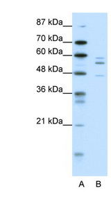PAX6 antibody LS-B991 Western blot of HepG2 cell lysate.