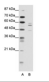 A: Marker, B: HepG2 Cell Lysate
