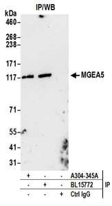 Detection of Human MGEA5 by Western Blot of Immunoprecipitates. Samples: Whole cell lysate (0.5 or 1.0 mg per IP reaction; 20% of IP loaded) from HeLa cells. Antibodies: Affinity purified rabbit anti-MGEA5 antibody used for IP at 6 ug per reaction. MGEA5 was also immunoprecipitated by rabbit anti-MGEA5 antibody BL15772. For blotting immunoprecipitated MGEA5, was used at 1 ug/ml. Detection: Chemiluminescence with an exposure time of 30 seconds.