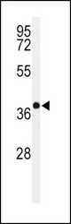 Western blot of PAX6-T373 in Y79 cell line lysates (35 ug/lane). PAX6 (arrow) was detected using the purified antibody.