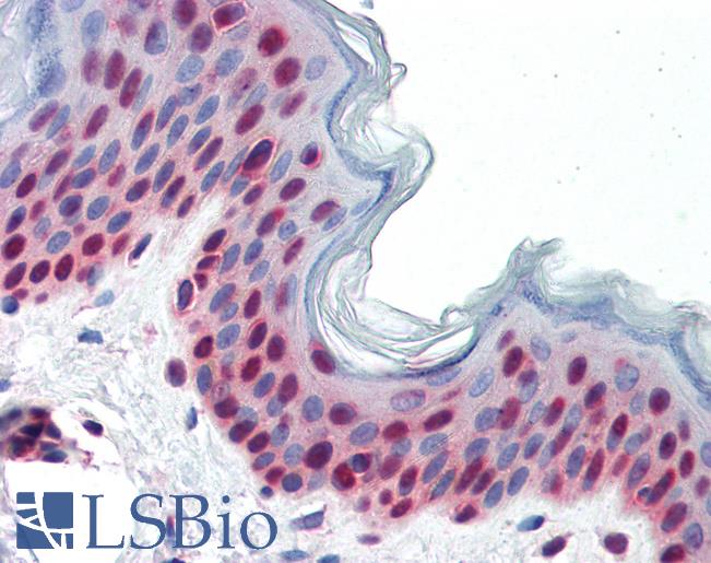 Anti-PAX7 antibody IHC of human skin. Immunohistochemistry of formalin-fixed, paraffin-embedded tissue after heat-induced antigen retrieval. Antibody LS-B3490 concentration 5 ug/ml.