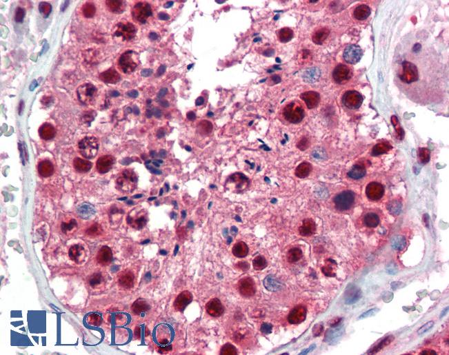 Anti-PAX7 antibody IHC of human testis. Immunohistochemistry of formalin-fixed, paraffin-embedded tissue after heat-induced antigen retrieval. Antibody LS-B3490 concentration 5 ug/ml.