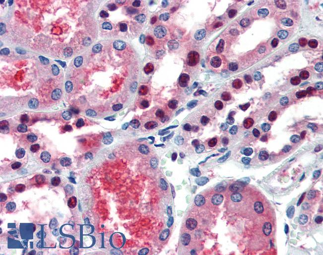 Anti-PAX7 antibody IHC of human kidney. Immunohistochemistry of formalin-fixed, paraffin-embedded tissue after heat-induced antigen retrieval. Antibody LS-B3490 concentration 5 ug/ml.