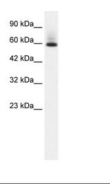 Jurkat Cell Lysate.