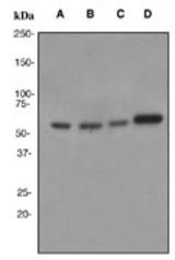 Western blot analysis on (A) 293T, (B) HeLa, (C) Jurkat and (D) HepG2 cell lysates using anti-PAX7 antibody (LS-C105693).