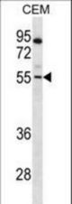 PAX7 Antibody western blot of CEM cell line lysates (35 ug/lane). The PAX7 antibody detected the PAX7 protein (arrow).