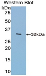 Western blot of recombinant O-GlcNAcase / MGEA5.