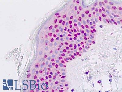 Anti-PAX7 antibody IHC staining of human skin, epidermis. Immunohistochemistry of formalin-fixed, paraffin-embedded tissue after heat-induced antigen retrieval.