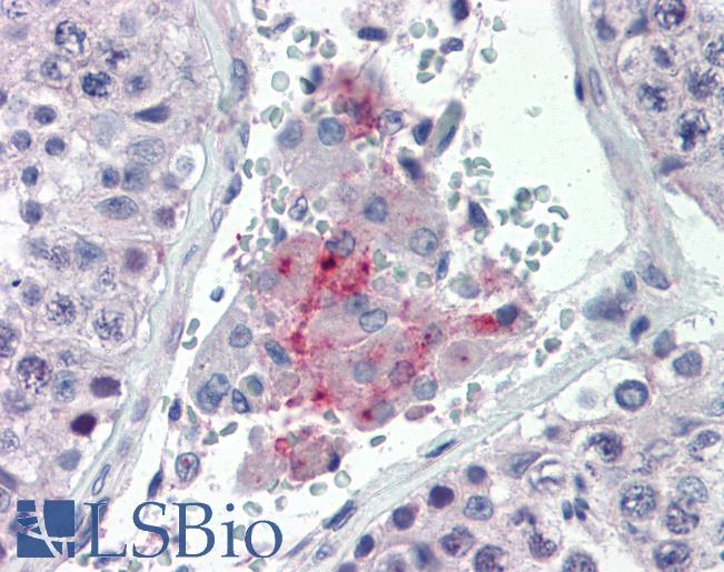 Anti-PAX7 antibody IHC of human testis. Immunohistochemistry of formalin-fixed, paraffin-embedded tissue after heat-induced antigen retrieval. Antibody LS-B3499 concentration 10 ug/ml.