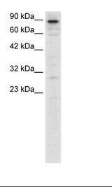 HepG2 Cell Lysate.
