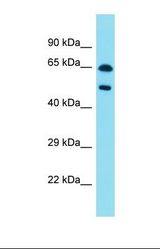 Western blot of Human Pancreas Tumor. PAX8 antibody dilution 1.0 ug/ml.